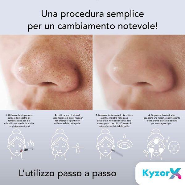 Aspiratore Punti Neri con Rullo di Giada - immagine 3